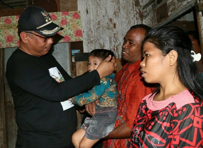 Plt Walikota Medan, Akhyar Nasution menjenguk Alfred Tegar Manurung, bocah berusia dua tahun delapan bulan penderita stunting.