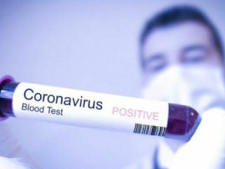 Virus Corona/Covid-19 (Ilustrasi).