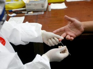 Jalani Rapid Test, 1 Karyawan PD Pasar Medan Reaktif