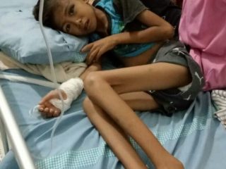 Seorang bocah bernama Ahmad Aldi (8) Warga Jermal 14 No 10 Kecamatan Medan Denai yang menderita sakit paru dan tipes dibawa ke RS Pirngadi Medan untuk mendapatkan perawatan intensif.