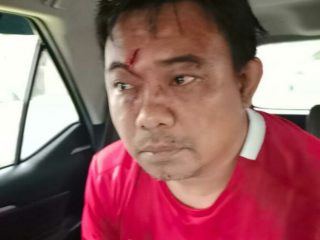 Ketua Umum KNPI, Haris Pertama dihajar oleh lebih dari tiga orang tidak dikenal (OTK) di depan Rumah Makan Garuda, kawasan Cikini sekira Pukul 14.10 Wib, Senin (22/2/2022).