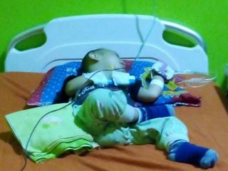 Balita Penderita Leukemia di Langkat Harapkan Bantuan Dermawan