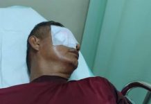 Seorang guru di SMAN 7 Rejang Lebong, Bengkulu, Zuharman (58) mengalami luka parah usai matanya diketapel oleh orang tua murid bernama Arpanjaya(45).