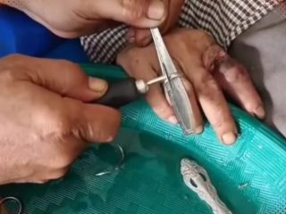 Tim Damkarmat Kota Medan berhasil melepaskan sejumlah cincin di jari seorang pria yang sudah melekat dan susah dilepaskan